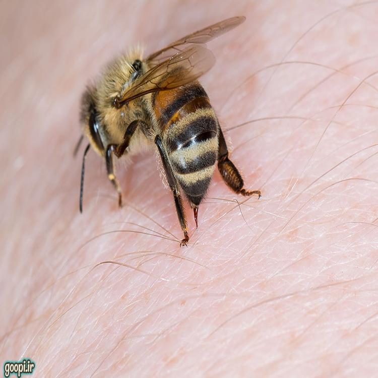 بهترین روش ها برای درمان خانگی نیش زنبور
