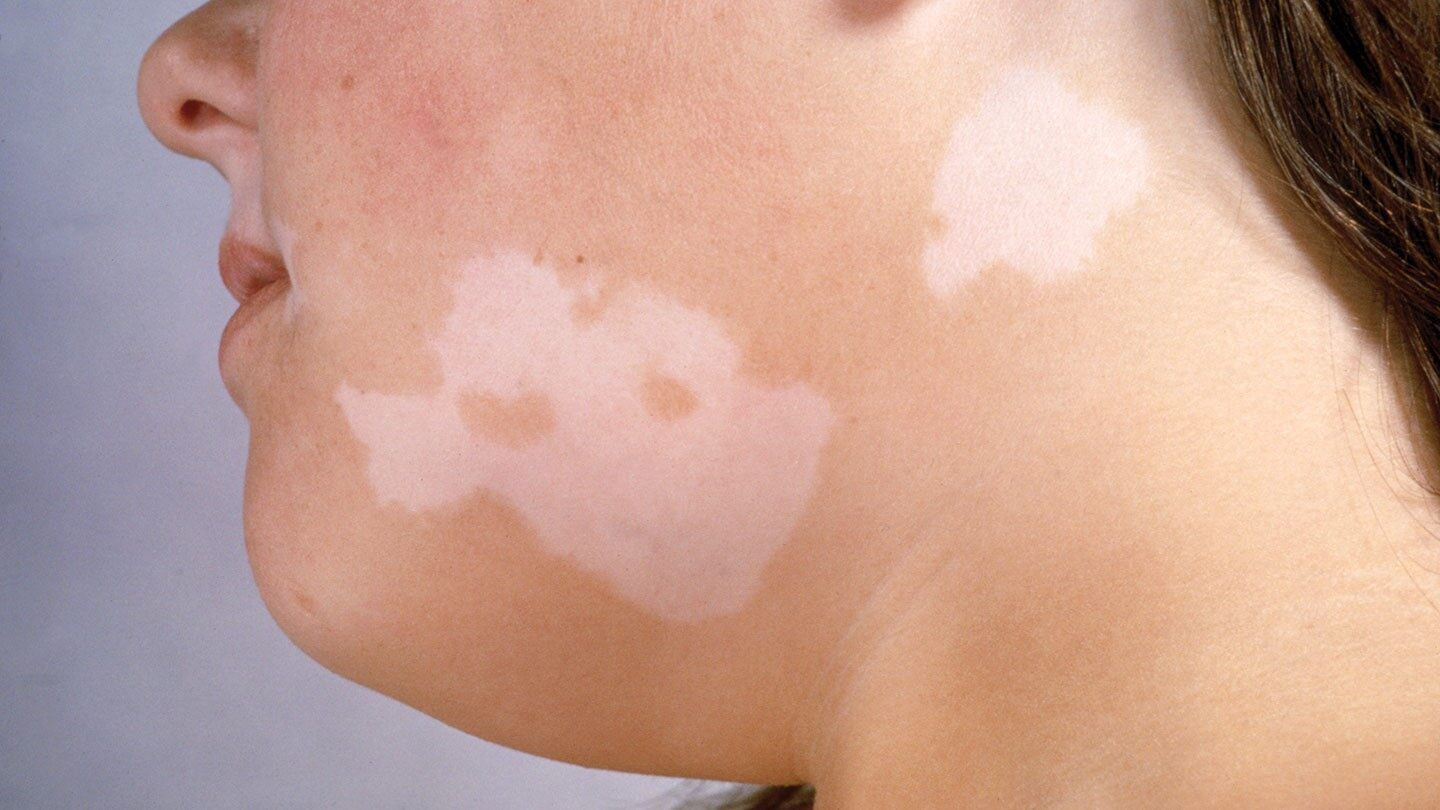 علل مشکلات پوست شما چیست؟