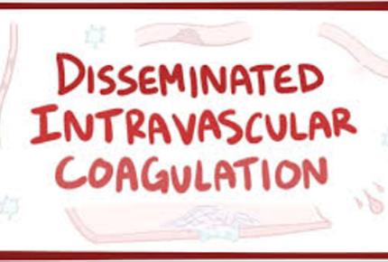 انعقاد داخل  عروق  منتشر Disseminated intrar ascular coagulation