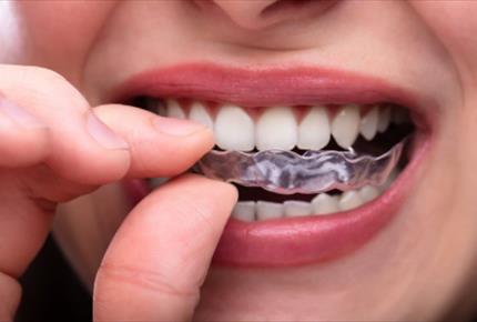 نگاهی به علل دندان قروچه و راه های درمان آن