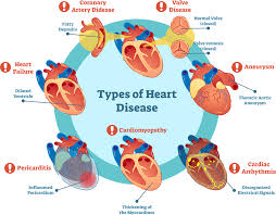 آیا عوامل خطر بیماریهای قلبی خود را می شناسید؟