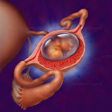حاملگی نابجا یا اکتوپیک-مجله مادرو کودک گوپی