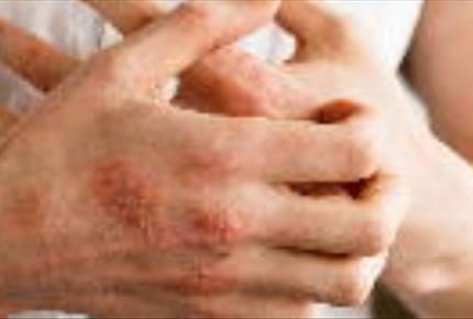 آشنایی با دلایل خارش بدن و راه های درمان آن- مجله مادر و کودک گوپی
