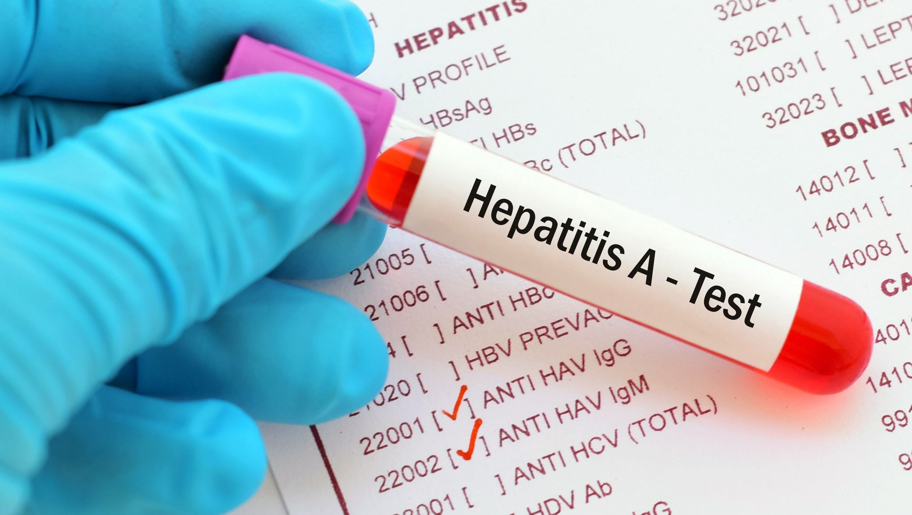 هپاتیت A چیست ؟