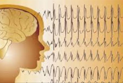 طوفان الکتریکی در مغز