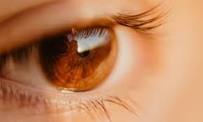 آب سیاه چشم ، نوع  زاویه  بسته  اولیه  Glaucoma primary close angle