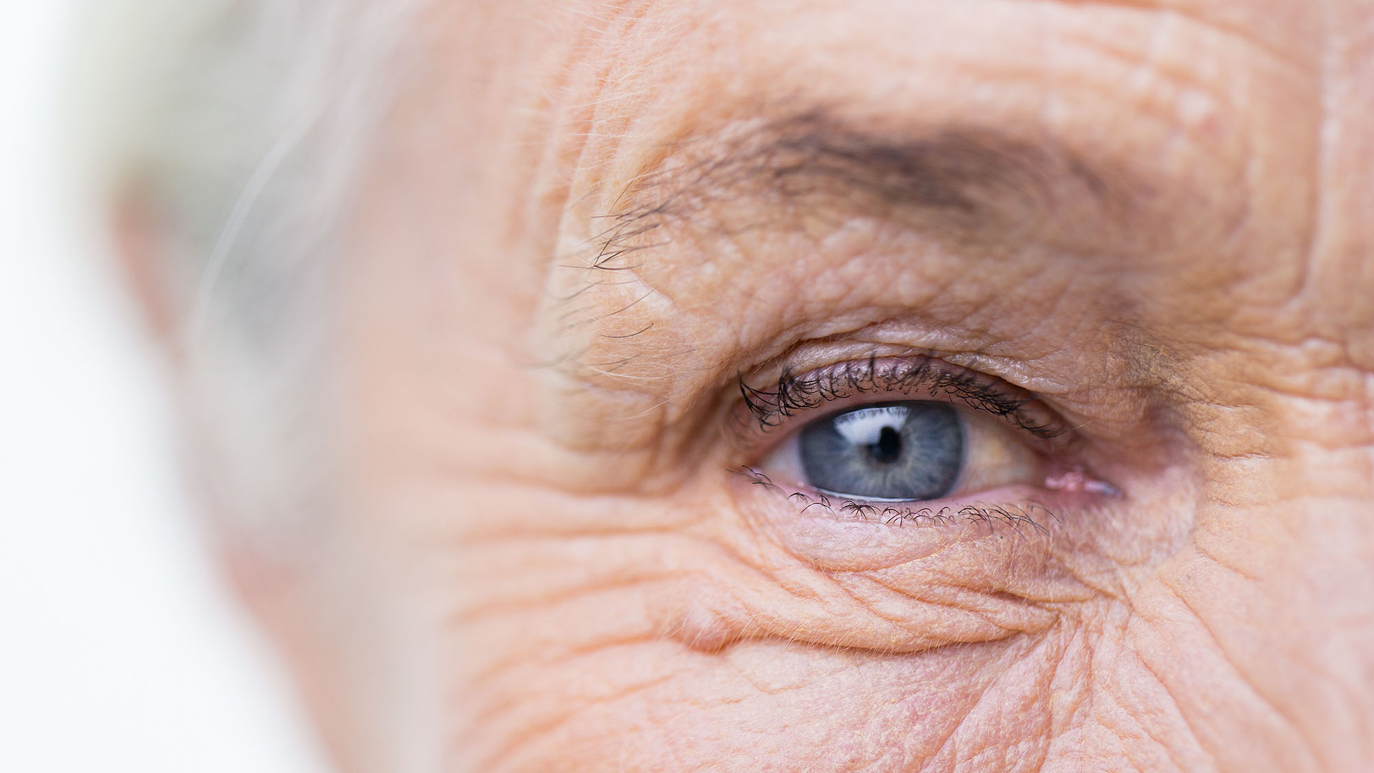 پیر چشمی محدودیت در سالمندان