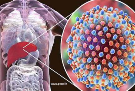 هــــپــــاتیـــــت چیست؟- مجله مادر گوپی