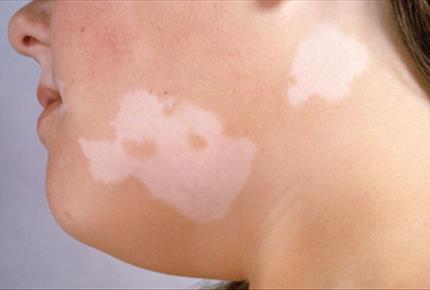 علل مشکلات پوست شما چیست؟