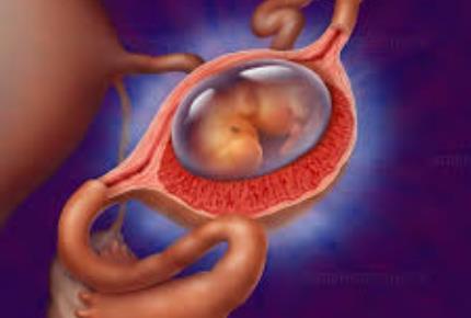 حاملگی نابجا یا اکتوپیک-مجله مادرو کودک گوپی