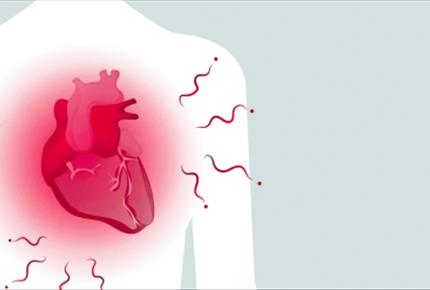 اسید اوریک و خطر قلبی  ـ عروقی