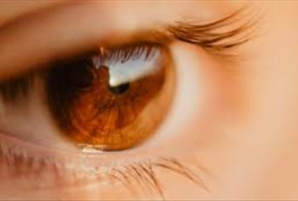 آب سیاه چشم ، نوع  زاویه  بسته  اولیه  Glaucoma primary close angle
