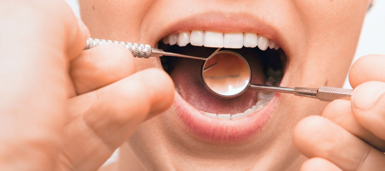 اختلالات شایع دهان در سالمندان